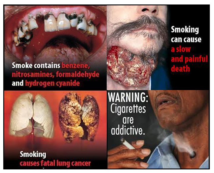 해외 담배의 경고 그림